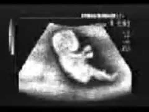 Belum lahiran udah jadi Joki 😀😁