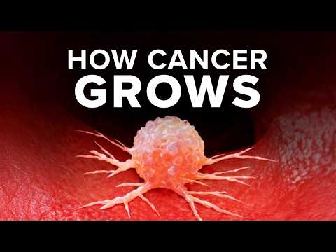 Angiogenesis Foundation and Dr. William Li