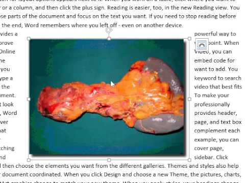 Dr Nitin Session for AIIMS