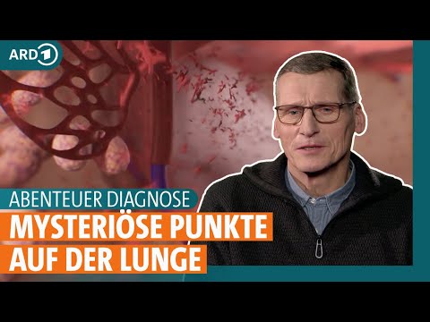 Abenteuer Diagnose: Was steckt hinter Gelenkschmerzen, Fieber und Hautausschlägen?