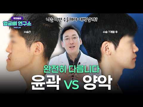 양악수술 vs 윤곽수술 차이 어떻게 다를까? 나에게 맞는 수술 찾는 법 