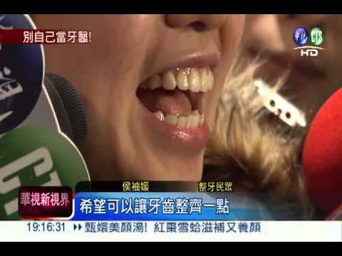 嫌自己暴牙! 民眾壓到門牙斷