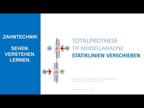 TiF Modellanalyse Statiklinien verschieben