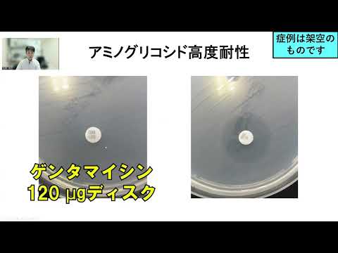 看護学科 今日のグラム染色この一枚 Enterococcus faecalisによる感染性心内膜炎