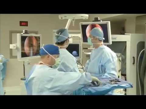 Robotic Endonasal Skull Base Surgery With Tentacle-Like Manipulators