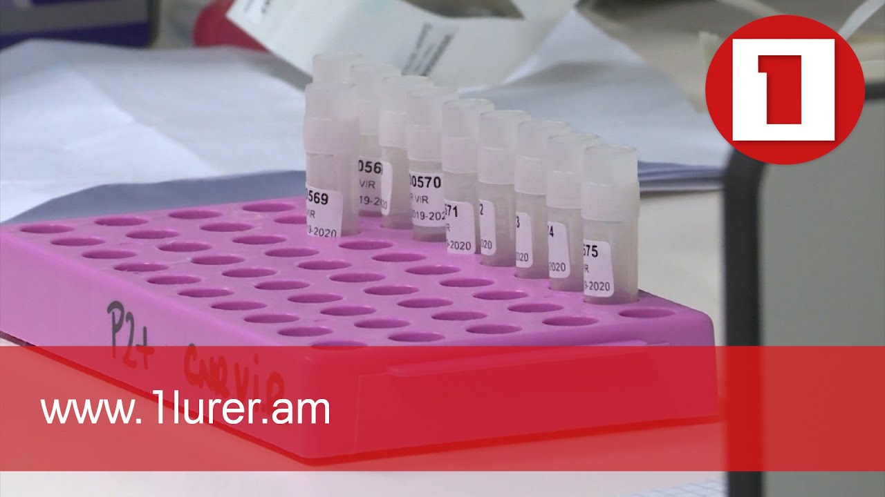 Քովիդը կարող է առաջացնել նաև հոգեկան խնդիրներ՝ որպես հետևանք