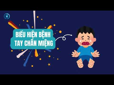Dấu hiệu nhận biết và cách phòng chống bệnh Chân Tay Miệng
