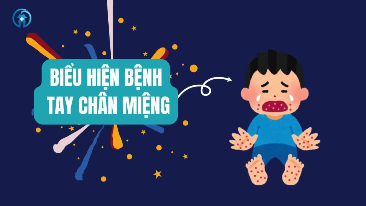 Bệnh tay chân miệng, dấu hiệu nhận biết, các biện pháp phòng bệnh