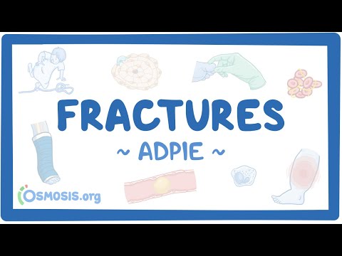 Chronic obstructive pulmonary disease Nursing Process
