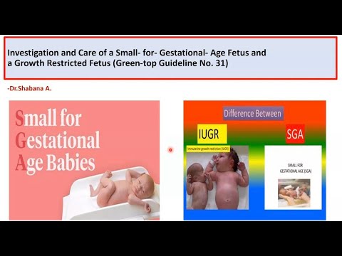SGA and FGR - New GTG for Mrcog part 2 & part 3 by Dr.Shabana A.