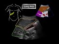 POCUS - Gallbladder Ultrasound Anatomy