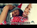 Circumcision Care For Your Baby