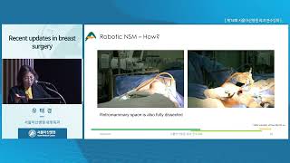 제18회 서울아산병원 외과 연수강좌 : Recent updates in breast surgery 미리보기