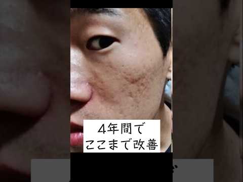 バック(クレーター)について詳しく解説