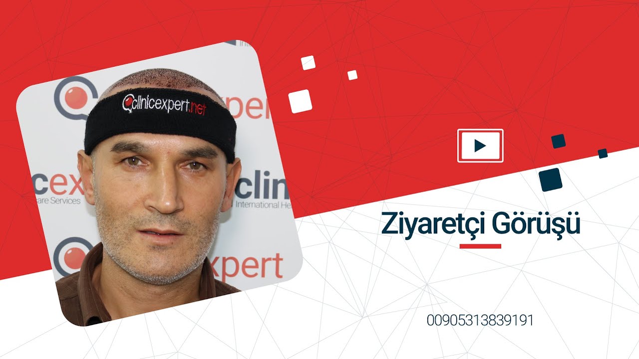 Saç Ekimi ve Estetik Cerrahi