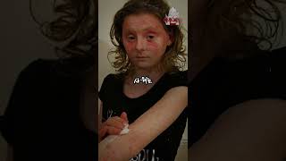 Download lagu 물 조차 편히 마실 수 없는 ‘물 알레르기’...? mp3