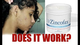 Get Rid Of Pimples In 3 Days Using Diaper Rash Ointment? & My Skin Care Routine