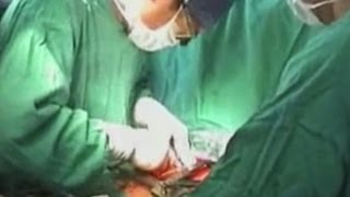 Dibunuh Untuk Organnya -- Bisnis Rahasia Transplantasi Negara China