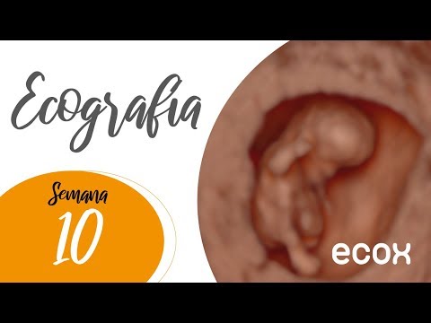 ¿Cómo es una ecografía 5D de 10 semanas de embarazo?
