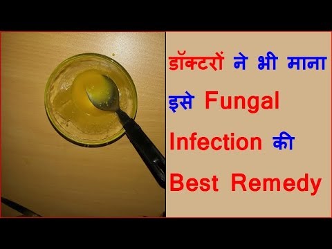 Nail treatment matapos shilaka Kung paano gamutin ang puting halamang-singaw sa katawan