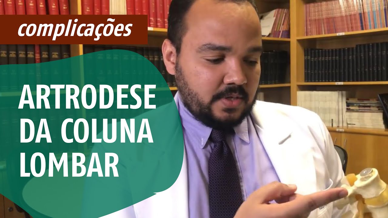 Principais Complicações na Cirurgia para Artrodese da Coluna Lombar