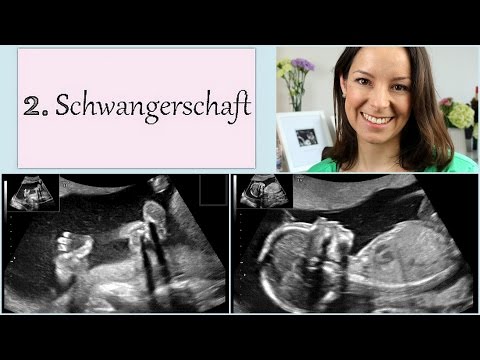 Armband Blutzuckerspiegel-Messung Glukosetoleranztest, oder genug Blutzucker