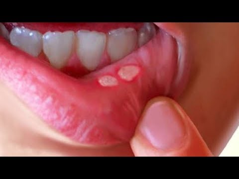 8 Things Your Face Can Tell About Your Health