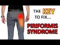 The KEY To Fix Piriformis Syndrome For Good DON T Stretch It