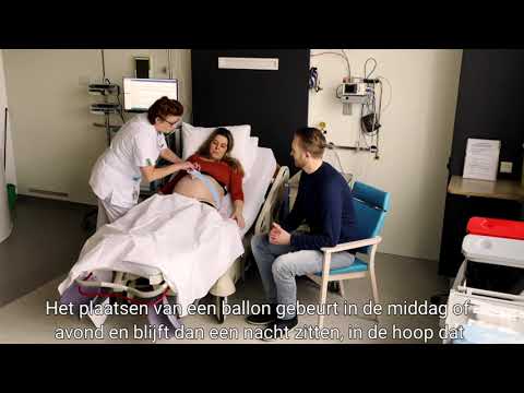 Inleiding van de bevalling