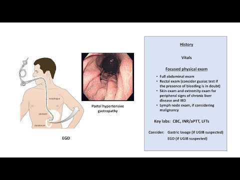 An Approach to GI Bleeding (Melena, Hematemesis, Hematochezia)