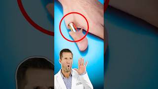 Médico de Emergencias Reacciona a Cómo Funciona la Cirugía de Dedo del Pie a Pulgar (Zack D. Films)