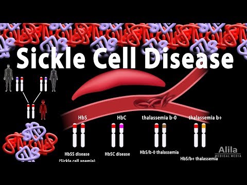 Sickle Cell Disease, Animation