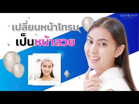 เมโสแฟต ยี่ห้อไหนดี