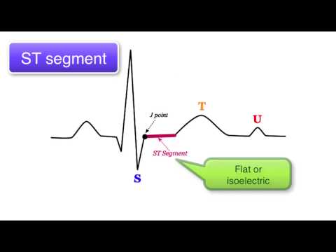 ECG Basics 9/10 - ST interval, T wave and U wave
