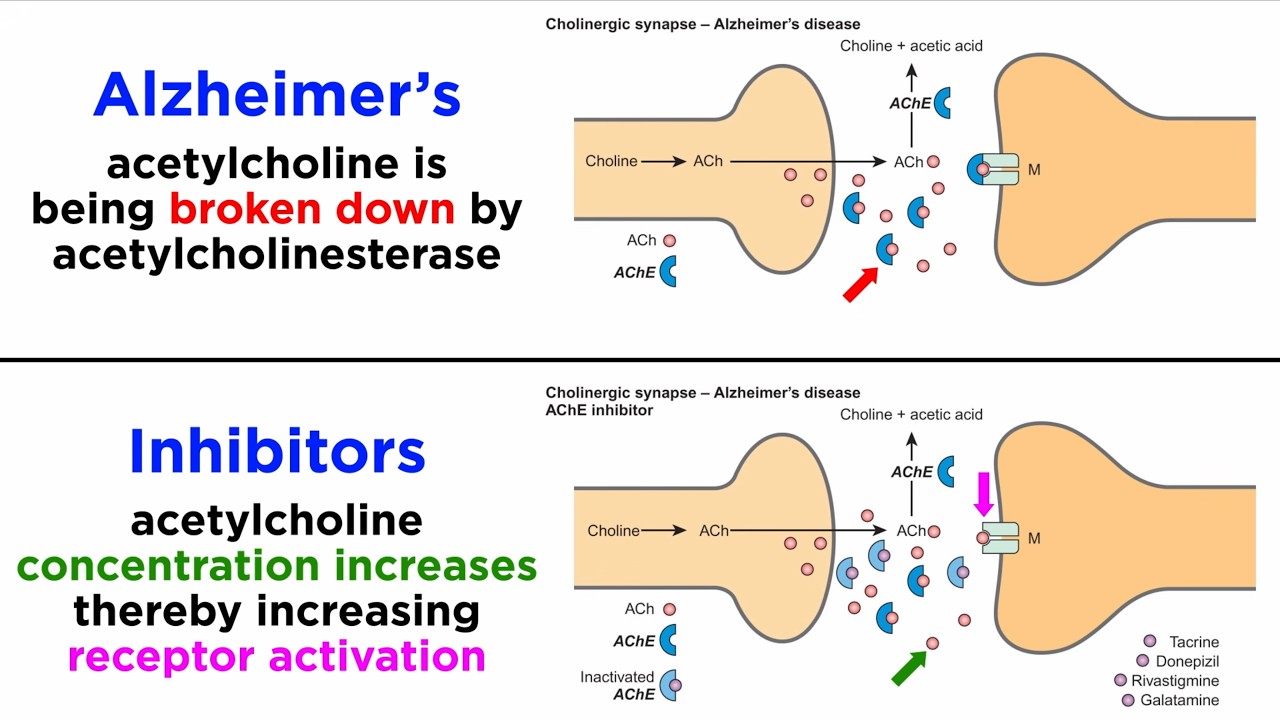 Alzheimer’s Disease: Cholinesterase Inhibitors and NMDA Receptor Antagonists