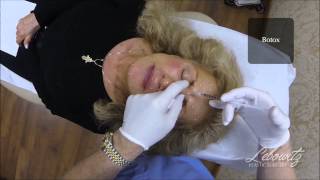 preview picture of video 'Facial Injections (Botox, Radiesse & Juvederm in Huntington Long Island NY by Dr. Lebowitz'
