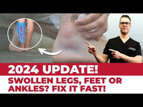 How to Lower Blood Pressure Causes Signs Symptoms What is it