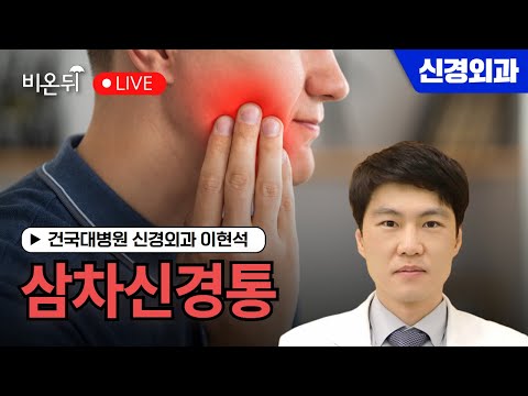 비온뒤 - 삼차신경통