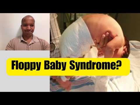 Floppy Baby Syndrome | Low Muscle tone (Hypotonia) Explained