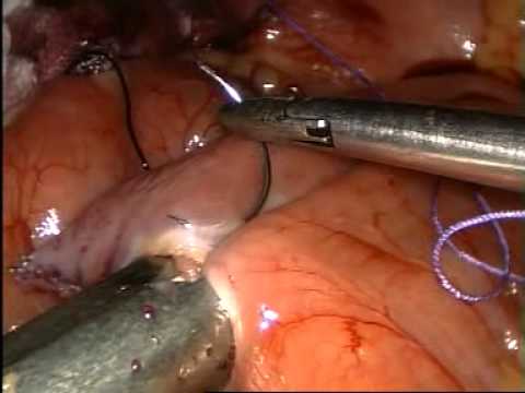 download lagu mp3 mp4 Dr Shashank Shah Mumbai, download lagu Dr Shashank Shah Mumbai gratis, unduh video klip Dr Shashank Shah Mumbai