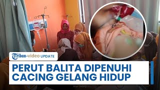 Diduga Akibat Infeksi Parasit, Balita di Bengkulu Jalani Operasi Usai Perutnya di Penuhi Cacing