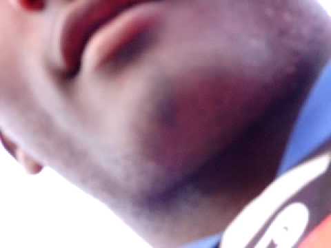 Brasil 1 x  0 Caxias