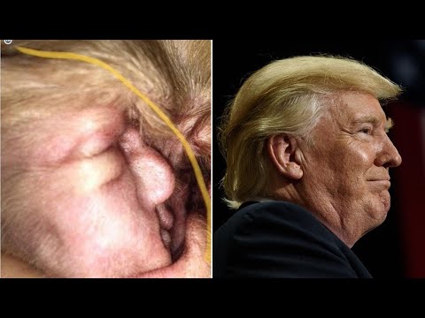 download lagu mp3 mp4 Donald Trump Dog Ear, download lagu Donald Trump Dog Ear gratis, unduh video klip Download Donald Trump Dog Ear Mp3 dan Mp4 Unlimited Gratis