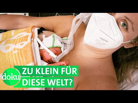Viel zu frühe Geburt: Unsere Drillinge wiegen nur 800 Gramm |  Drei Handvoll Leben (1/2) | WDR Doku