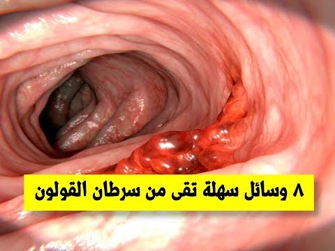 شاهد الفيديو