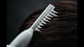 Regrowz Hair Loss Treatment l Does It Work? l 30 Day Hair Test