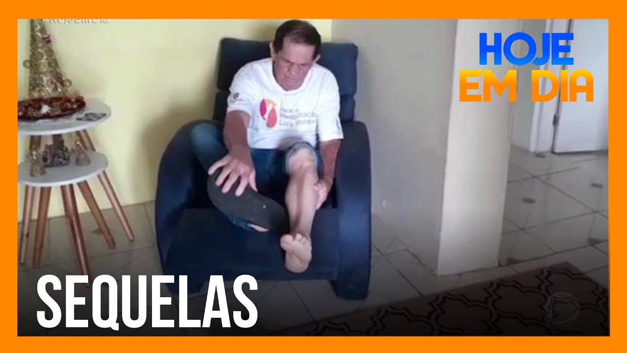 Covid-19 pode gerar graves sequelas em pacientes já curados