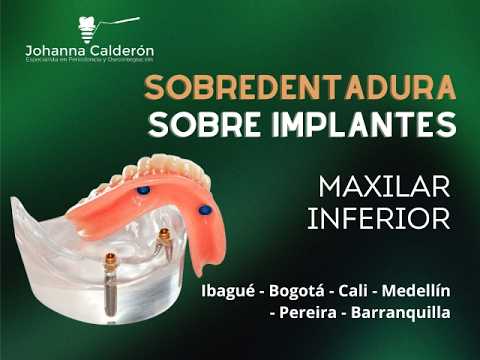 Johanna Andrea Calderón Bohorquez-40