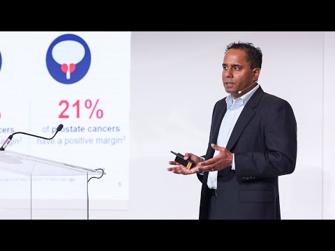 Adrian Mendes, Perimeter - Advanced Medical Imaging for Cancer Surgery | LSI USA '25