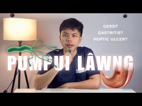 PUMPUI LÂWNG I HRIAT NGEI NGEI TUR POINT 10